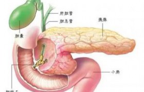 什么情况会引起急性胰腺炎？如何预防？